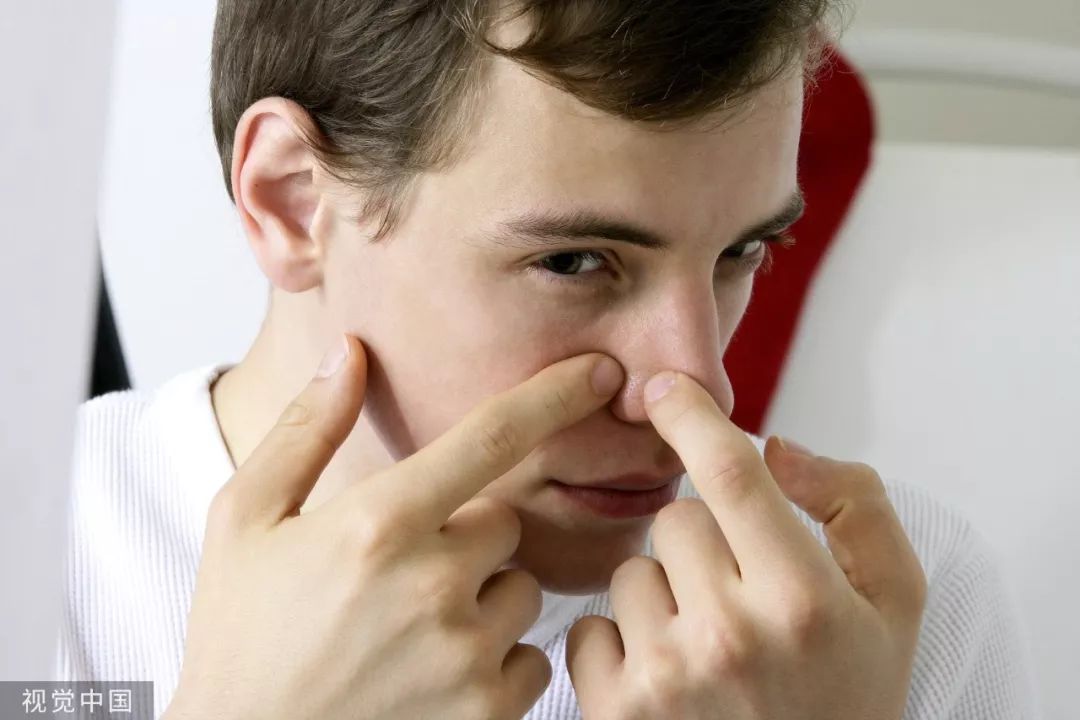 鼻子外面挤出来的白色东西臭臭的,鼻子头上挤出来的白色东西是什么