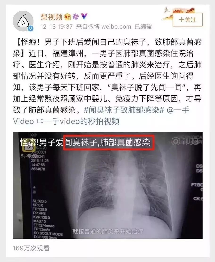日本人吃饭都不穿鞋，熏死人了！这双耗时3年的黑科技银离子袜，美白润肤自发热，穿7天都不臭脚