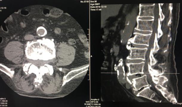 蒙自第一人民医院中医科,蒙自市中医院专家门诊
