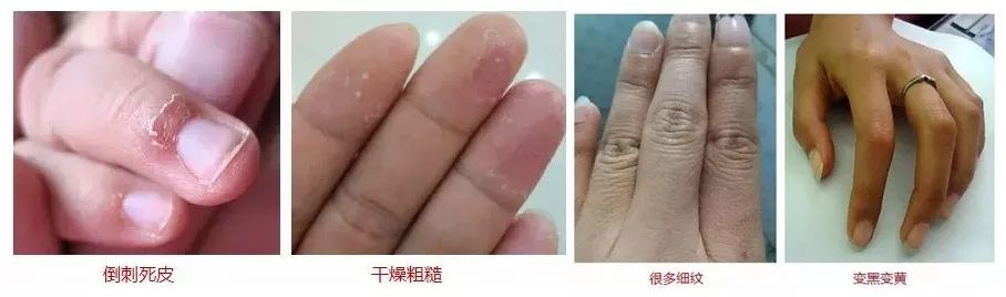 呵护手足|戴手套=精油SPA？还不耽误玩手机？30分钟急救手膜足膜，死皮老茧全消失，让你从头嫩到脚