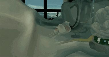 呼噜喷雾小孩能用吗,零到一岁的宝宝呼噜止鼾神器