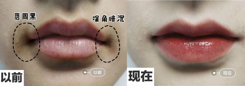 柔嫩抛光|脸上搓出3斤泥!难怪又黄又暗又黑头!10秒给脸蛋“剥壳”,厉害