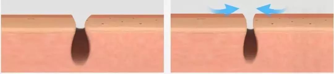 脸上搓下来很多泥,脸上搓出黑头