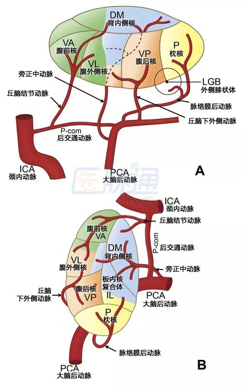 脑梗死的分类及ct影像学表现,丘脑梗死的临床表现