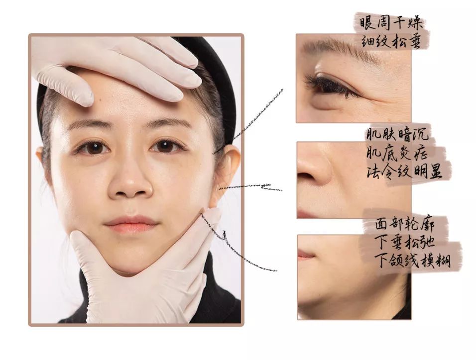 抗老三部曲紧致少女肌,抗老做好这五步hold住童颜少女肌