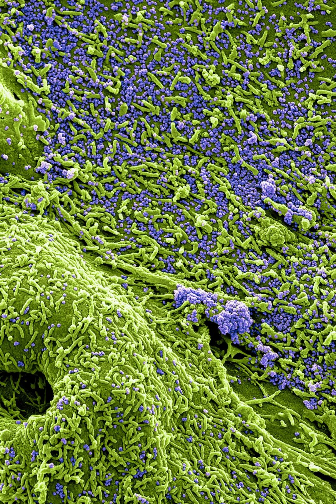 鍋囧鐥呮瘨鎰熸煋浜嗘垜,鍋囧鐥呮瘨鎰熸煋浜嗕綘
