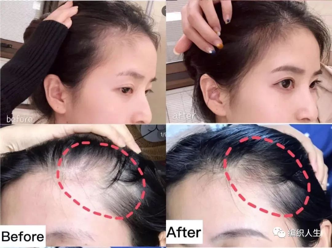 德国老太太用什么洗发水,93岁德国老太太