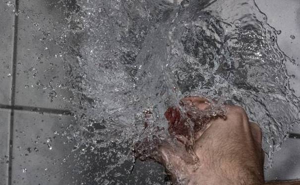 儿童开水烫伤急救处理,被开水烫伤怎么办最快最有效