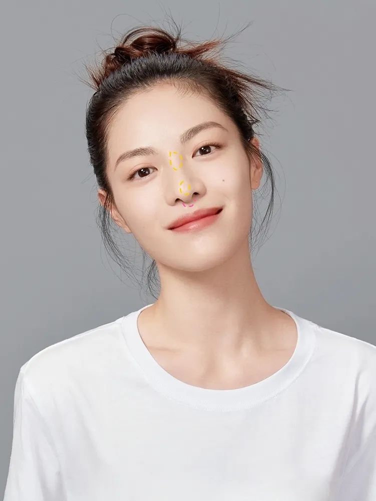 做了鼻镜后遗症,做了鼻基底都后悔吗