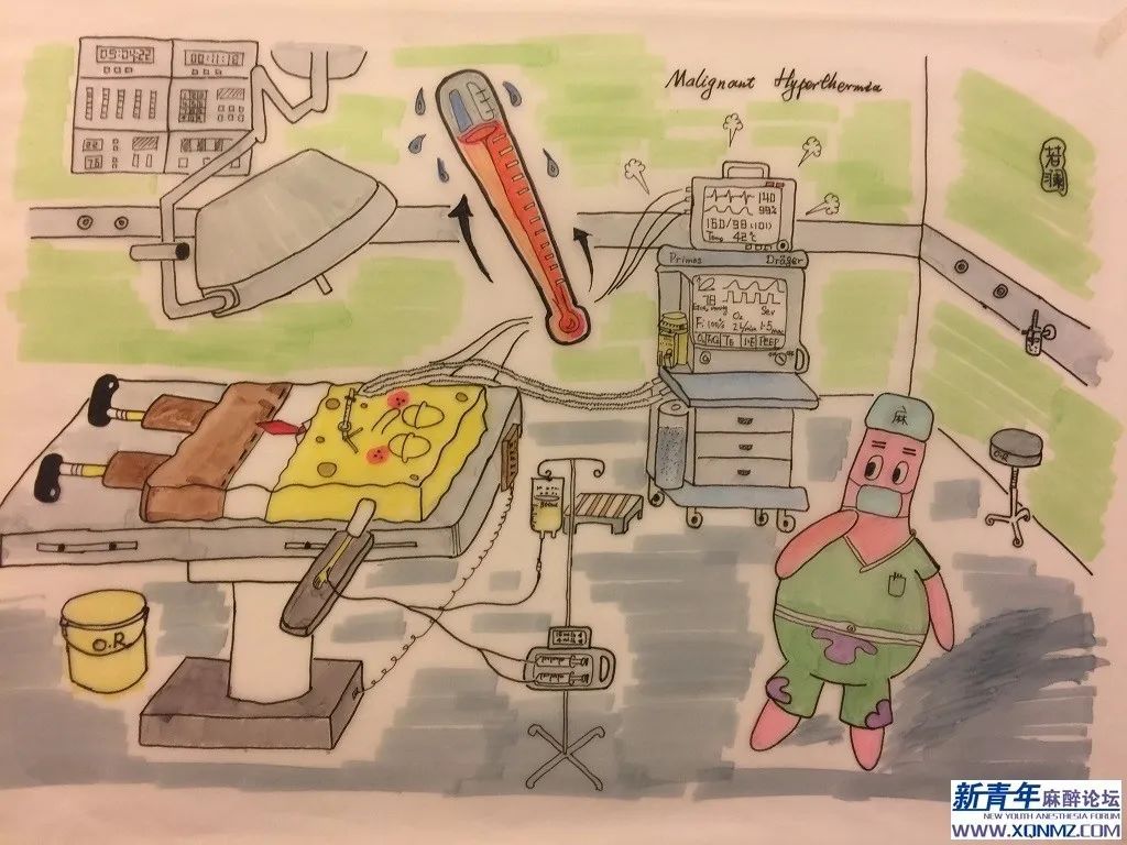 开腹子宫肌瘤剔除术个案分享,子宫切除后出现低热转高热