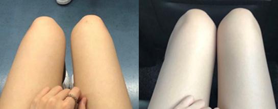 各类肌肤的实用美白技巧,美白牛奶肌的秘密在这里