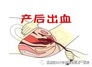 顺产6斤女宝宝生产过程痛不欲生,生完宝宝后大出血