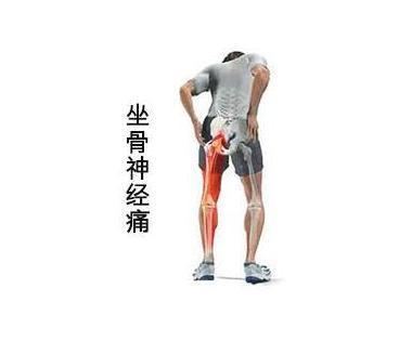 青少年自己得了椎间盘突出很担忧,二十岁就椎间盘突出