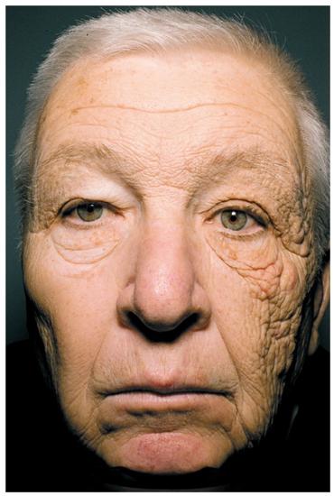 物理防晒（纳米VS非纳米颗粒）和化学防晒的优势劣势