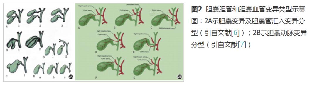 胆道外科有哪些操作,胆道疾病解剖基础知识