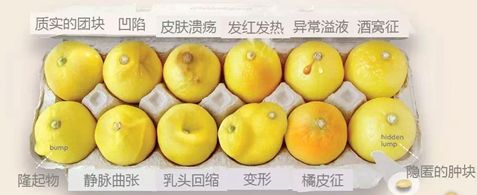 抗癌宣传周,带您“秒懂”乳腺钼靶报告