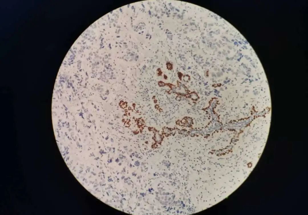 探秘病理科,病理科活检为什么慢