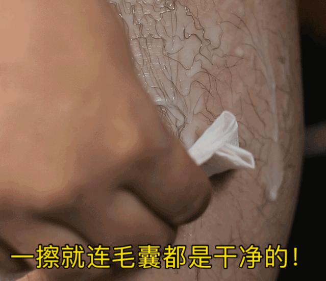 光滑无暇|黑丑的“毛裤腿”，用它，10分钟“脱”得一干二净，肌肤光滑细腻