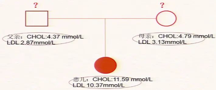 多发性黄色瘤,胆固醇高引起的黄色瘤是什么样的