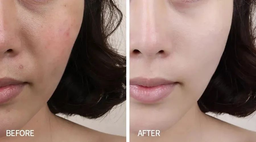 angelababy30岁素照,angelababy早期日本照