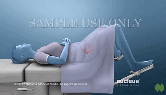 盘点医院各大科室侵入性检查：穿刺、内镜各显神通，小活检标本以“小”见“大”