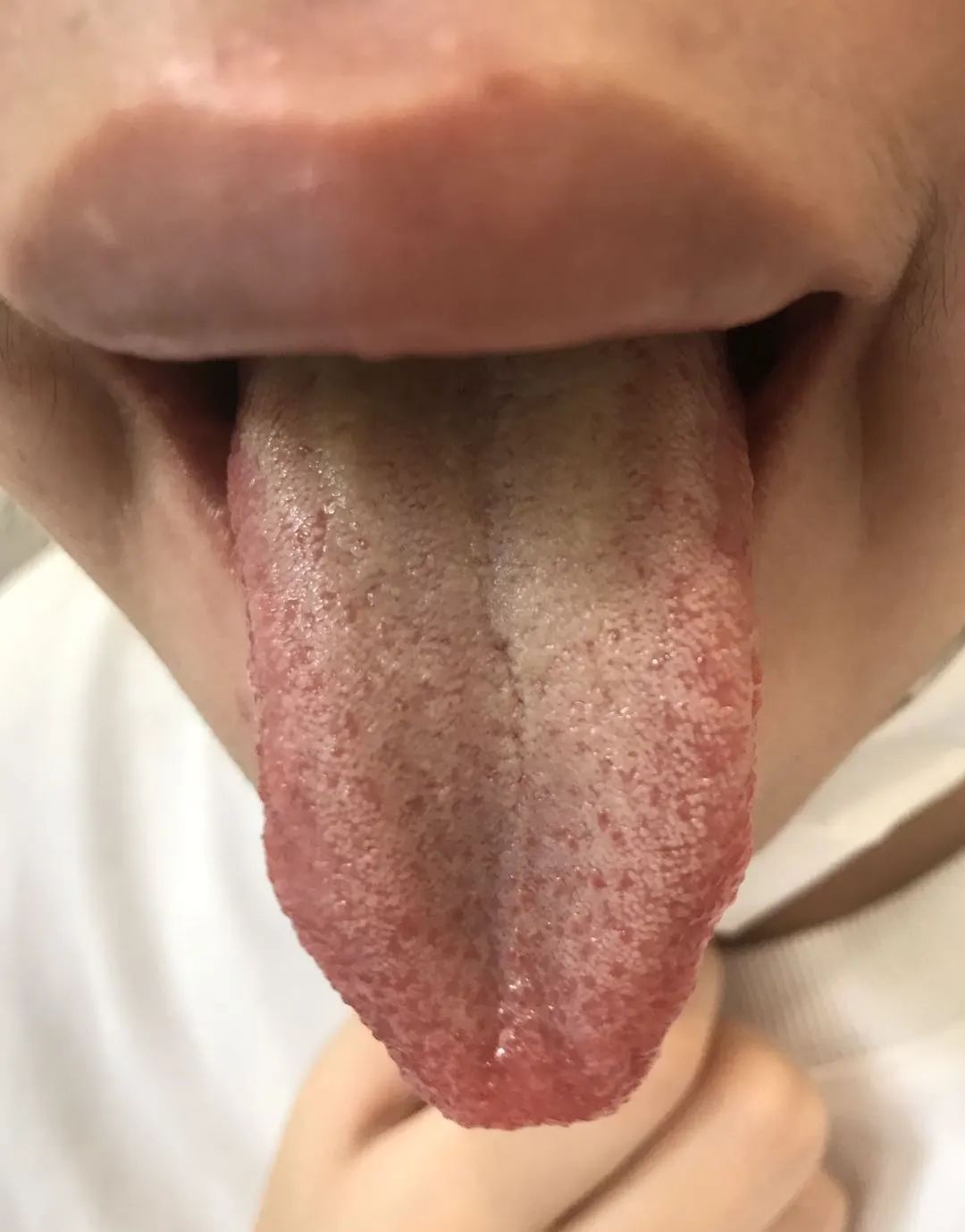 夏天6种事情千万要注意,夏天到了下面八件事要谨记