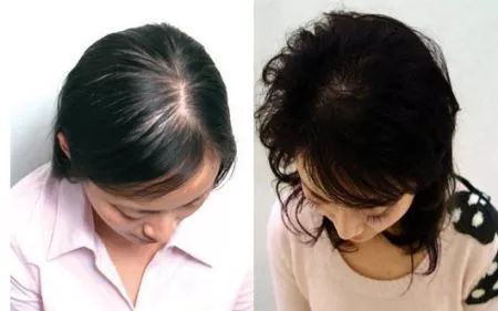 生姜防脱育发洗发水推荐,老姜王生姜防脱育发洗发水300ml