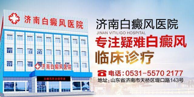 正确辨别白斑很重要,白斑病简便的鉴别方法