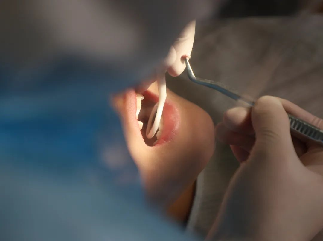 一岁小孩磕断两颗门牙有啥说法吗,两小孩无意碰撞牙齿磕断