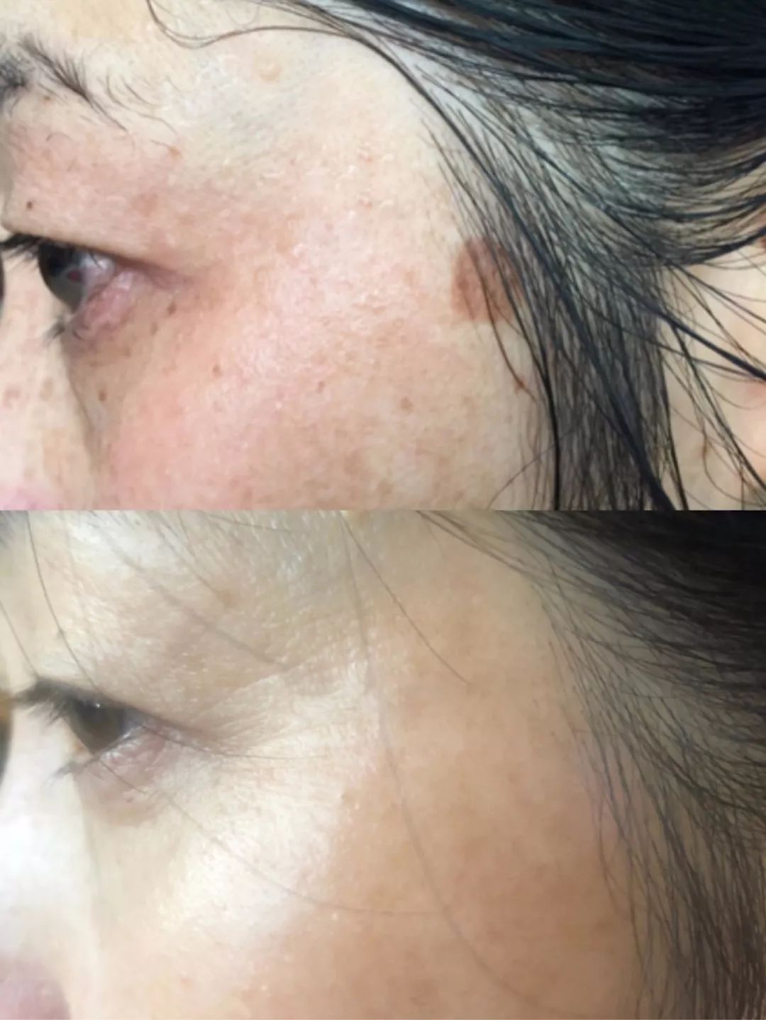 长期补充胶原蛋白的人怎么样了,长期喝胶原蛋白的人最后怎么样了