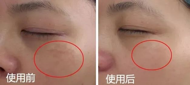 喝胶原蛋白要坚持多久才能有效果,紧急提醒经常喝这个的人要注意了