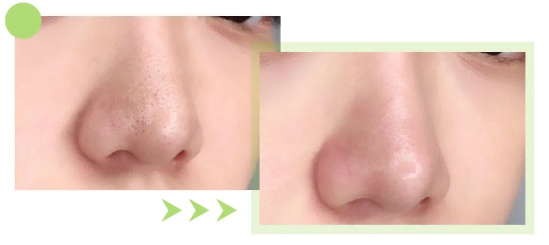 蜜诗肌酵素去角质凝胶,蜜诗肌酵素去角质