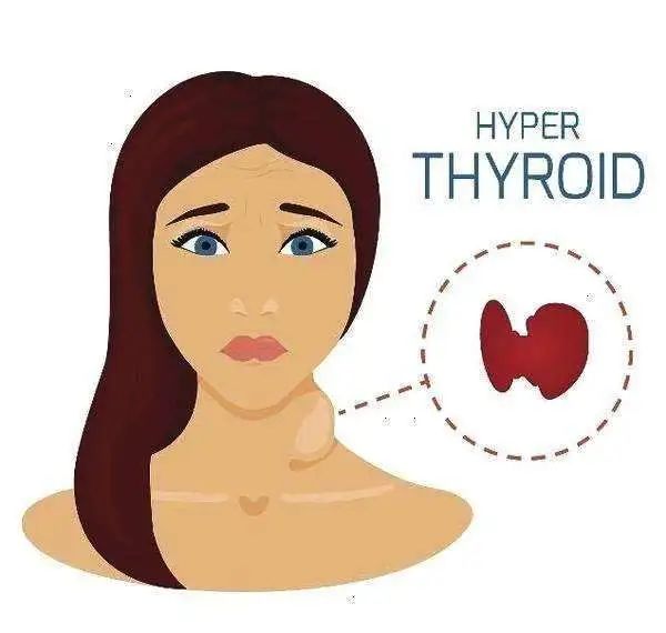 甲状腺复查要几天出结果,甲状腺复诊必须是3周吗