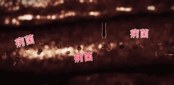 1罐搞定一整夏！20秒止痒消肿，让蚊虫再无嚣张机会