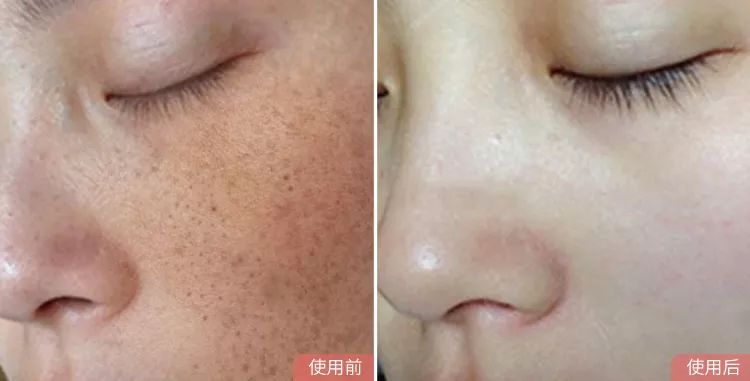 国货，你变了！这个平价“小灯泡”，白到情敌都发慌