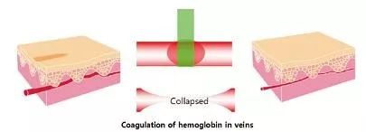 虞书欣手表100多万 (虞书欣医美费用)