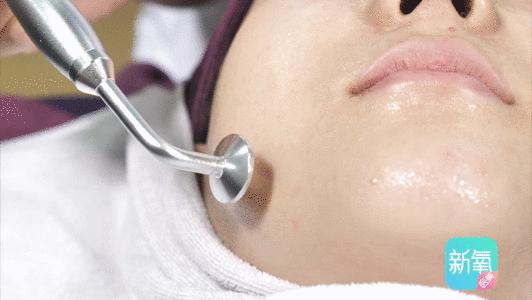 11块钱淡斑体验,1元享受美容养生护理无隐形消费