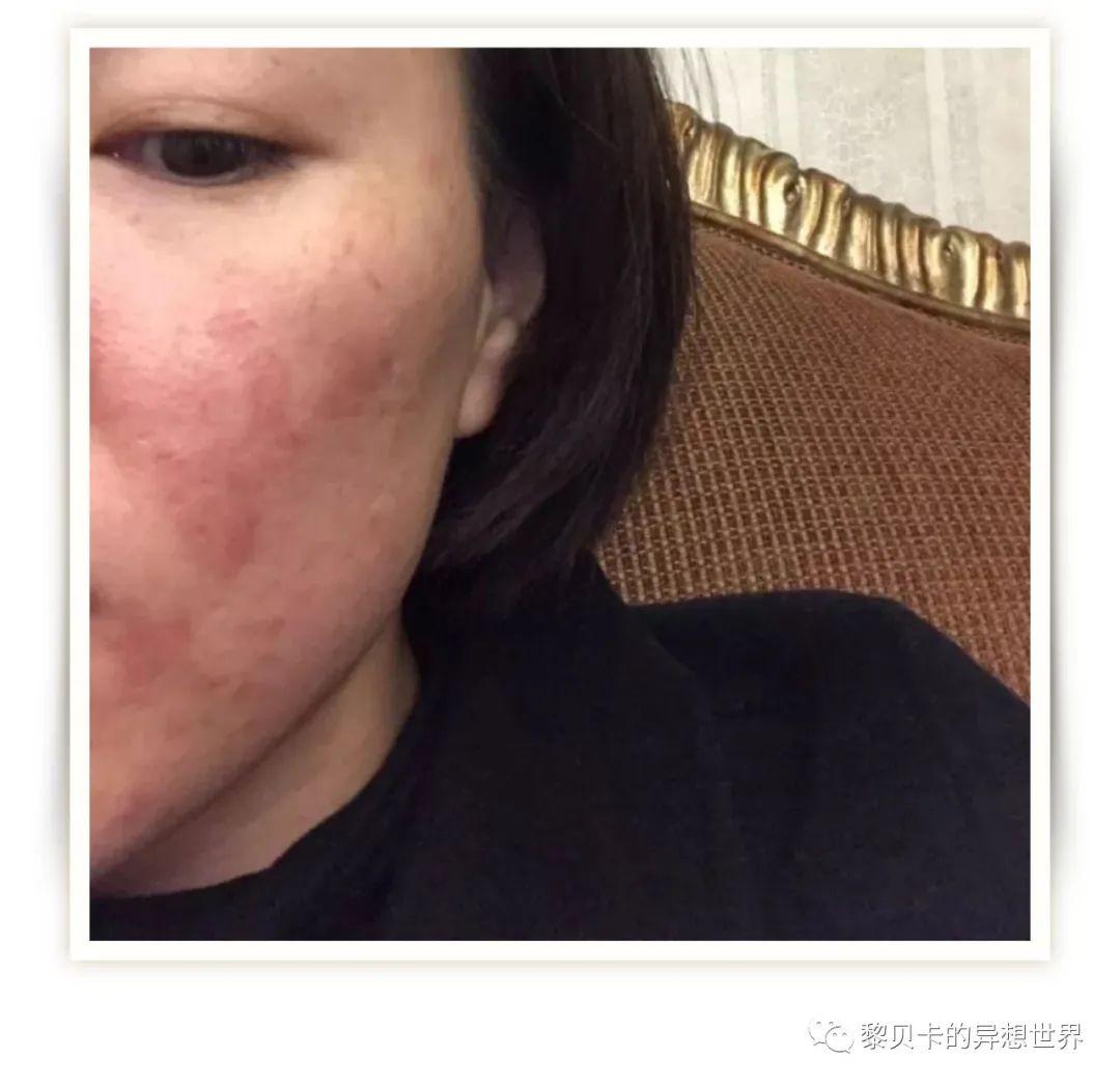 做完医美真的能换脸吗,做完医美需要注意什么