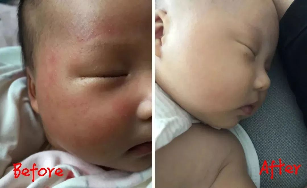 法国Lérane草本净螨贴，萃取天然植物，除螨更安心