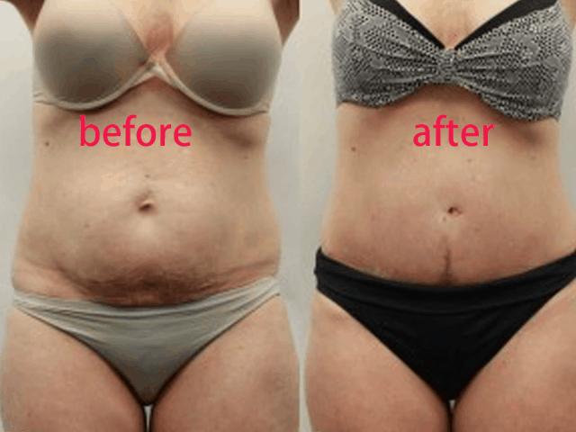 51岁王菲写真曝光,51岁的王菲旧照曝光