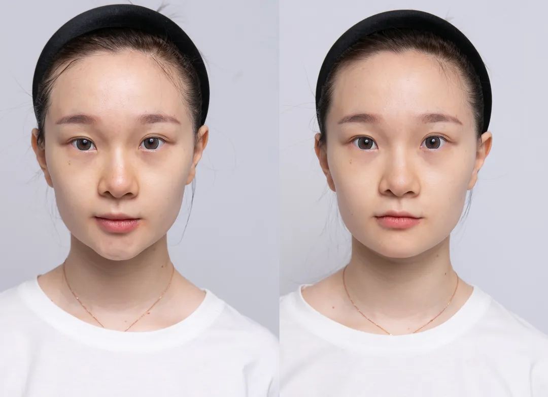 黄金美容真相,黄金美容护肤