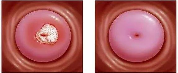 私密处日常护理最好的方法,25岁女性注意事项