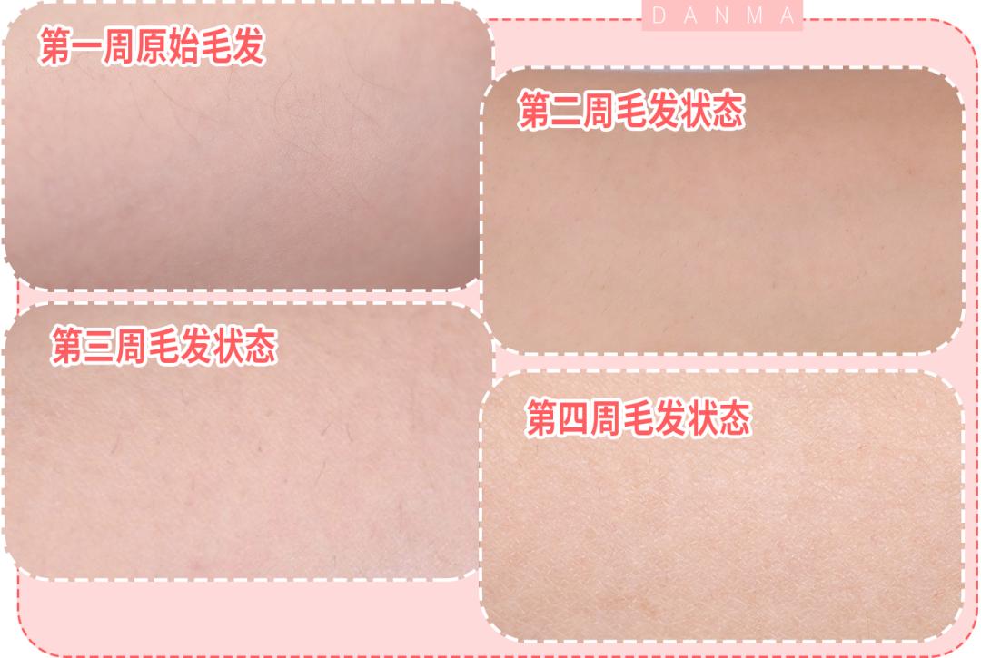 真实脱毛测评,官方测评真正有用的脱毛仪