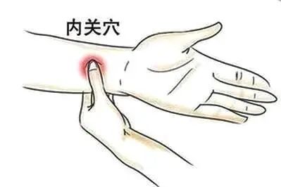 内关穴可以治疗心衰,内关穴适合所有心绞痛吗