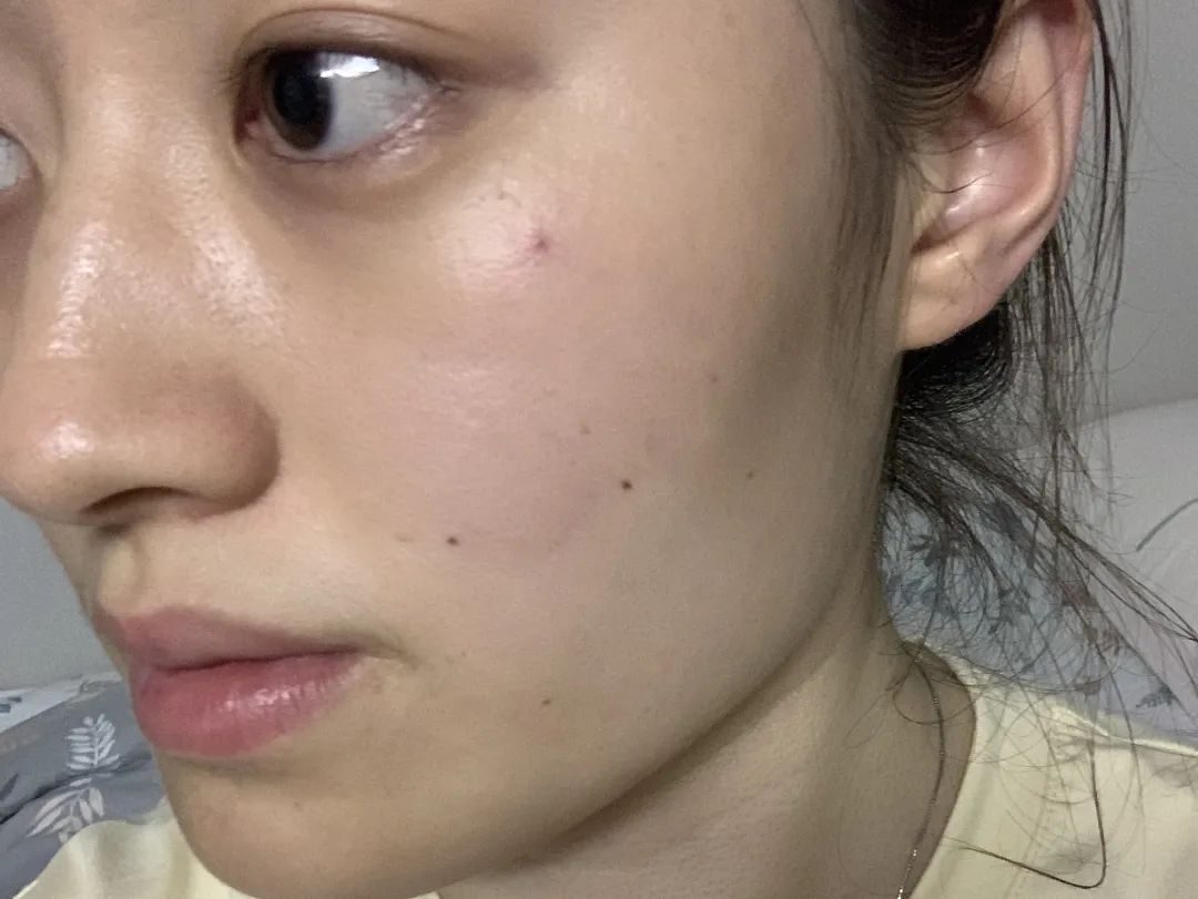 百人测评团|蒸笼天里，想让肌肤“一秒入水”，可能吗？