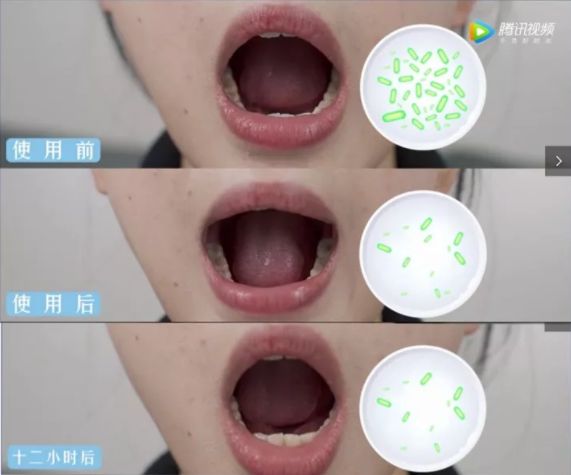 口臭的解决方法胃不好,口臭是不是胃不好了应该怎么调理