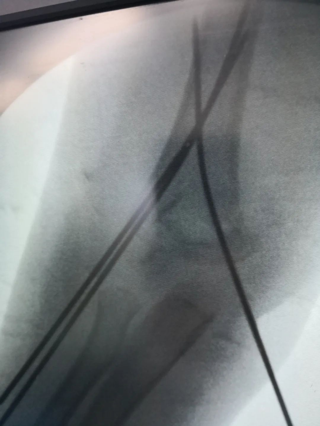 警惕！淄博一医院连续接诊4名孩子，受伤严重！很多家庭都有