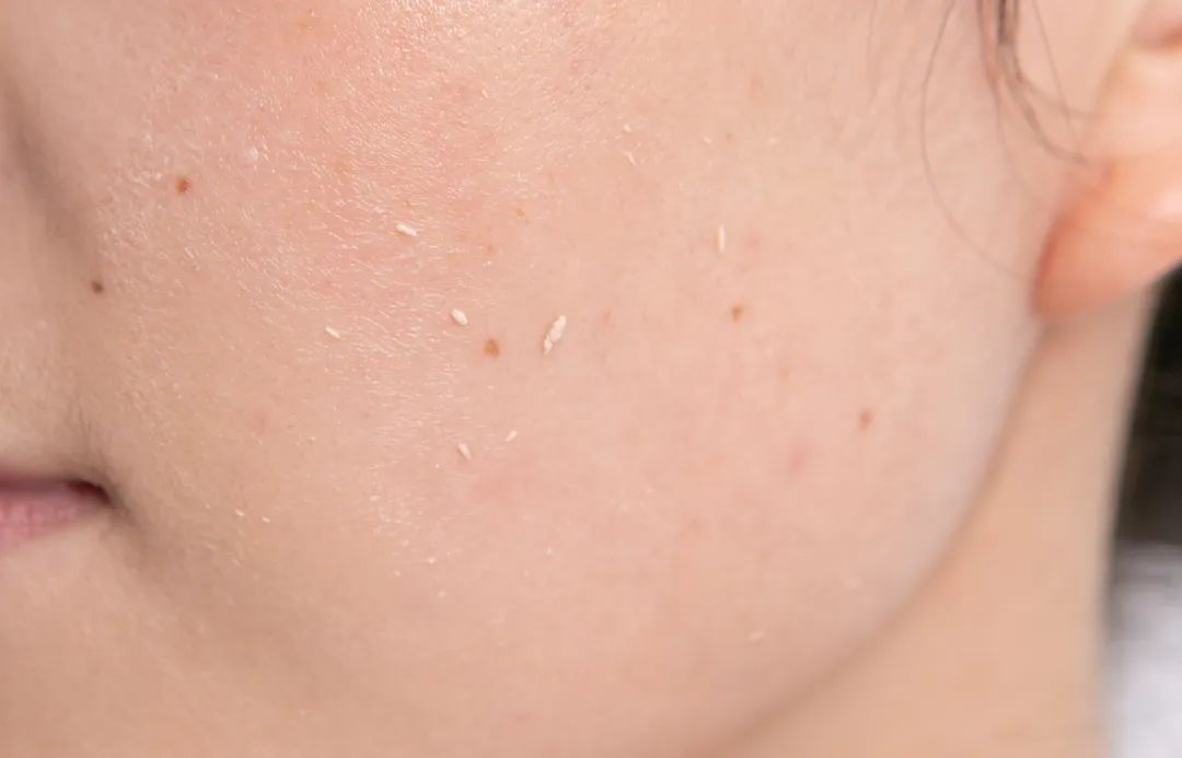 粉丝提问|有防晒,为什么身上很白,脸上很黑?