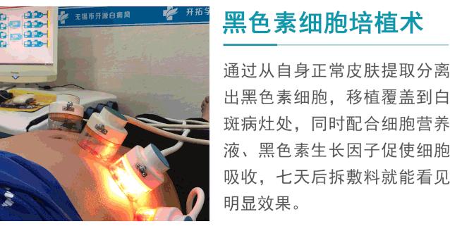 2024年全国白癜风患者救助计划,白癜风银屑病公益援助项目计划