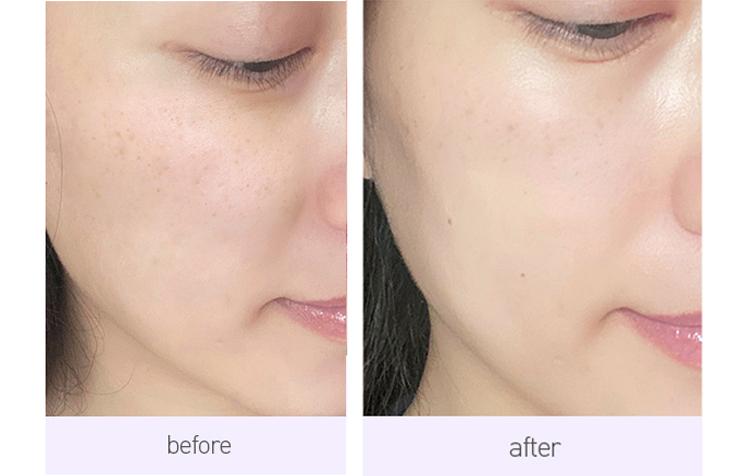 让脸上斑去掉,让脸上的皮肤变白